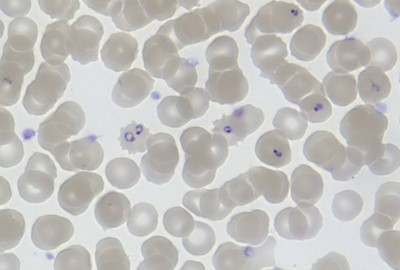 Em 2014, o dispositivo estará disponível para detectar o material genético do parasita causador da malária, o ‘Plasmodium’, no sangue do paciente. (foto: MichaelZahniser/ Wikimedia Commons)